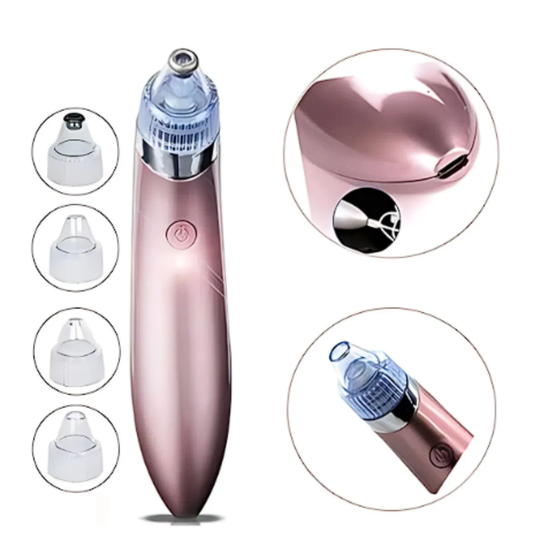 EXTRACTOR DE PUNTOS NEGROS